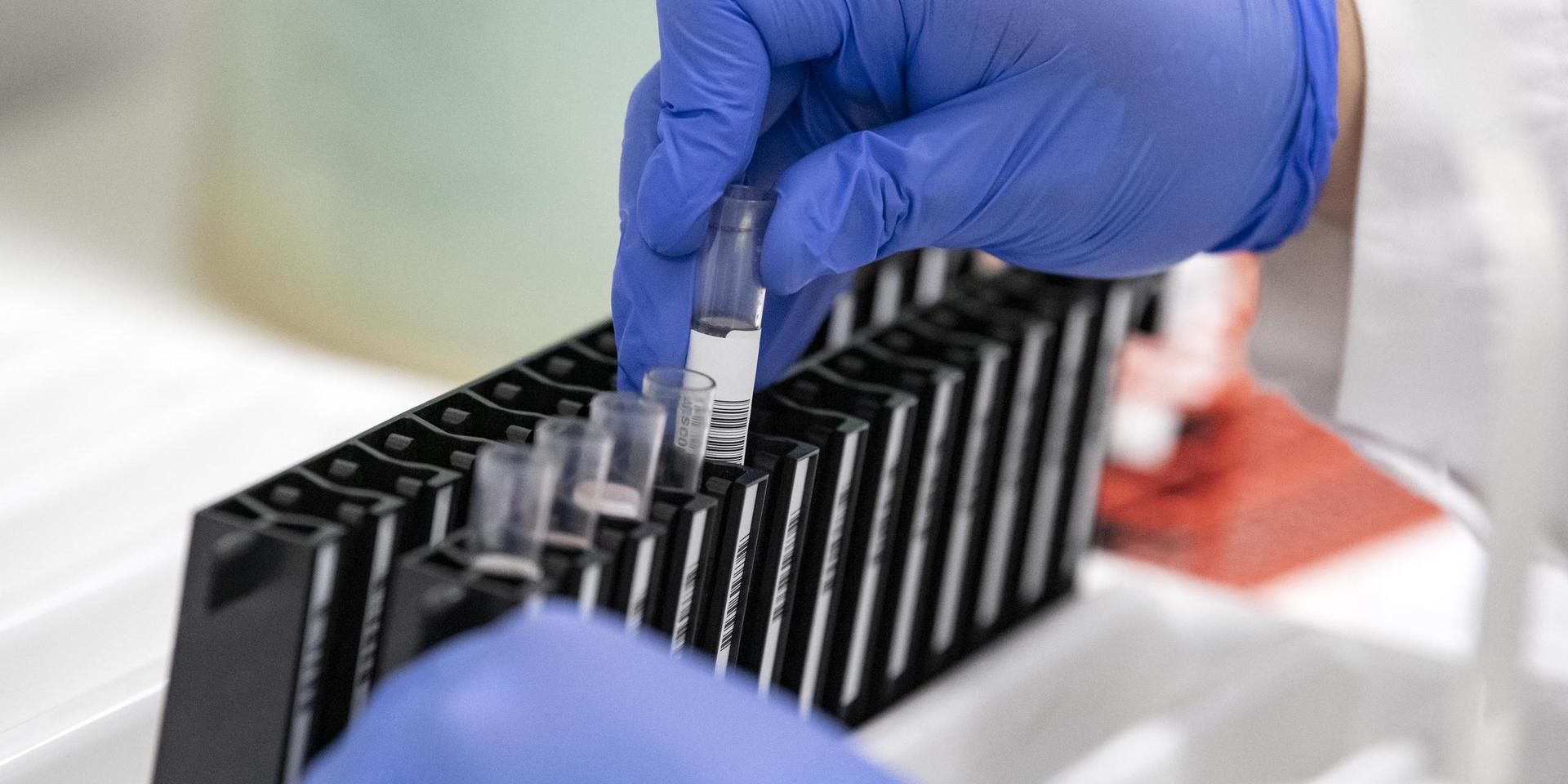 Blodprover som ska analyseras avseende antikroppar mot coronaviruset i ett laboratorium i i Lund.